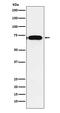 Cytoplasmic Polyadenylation Element Binding Protein 1 antibody, M03578, Boster Biological Technology, Western Blot image 