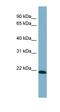 TIR Domain Containing Adaptor Protein antibody, orb330702, Biorbyt, Western Blot image 