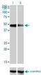 Cytokine Receptor Like Factor 1 antibody, H00009244-M01, Novus Biologicals, Western Blot image 