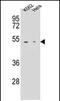 Carboxypeptidase B1 antibody, PA5-35093, Invitrogen Antibodies, Western Blot image 