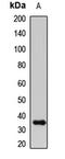 Insulin Like Growth Factor Binding Protein 2 antibody, LS-C667863, Lifespan Biosciences, Western Blot image 