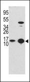 Microtubule Associated Protein 1 Light Chain 3 Beta antibody, LS-B9807, Lifespan Biosciences, Western Blot image 