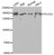 Phospholipase C Gamma 2 antibody, LS-C331963, Lifespan Biosciences, Western Blot image 