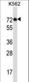 Interleukin 1 Receptor Like 2 antibody, LS-B9085, Lifespan Biosciences, Western Blot image 