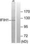 Interferon Induced With Helicase C Domain 1 antibody, TA326214, Origene, Western Blot image 