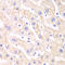 Proteasome Inhibitor Subunit 1 antibody, LS-C334133, Lifespan Biosciences, Immunohistochemistry frozen image 