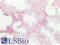 CD81 Molecule antibody, LS-B7347, Lifespan Biosciences, Immunohistochemistry paraffin image 