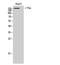 Colony Stimulating Factor 1 Receptor antibody, STJ92244, St John