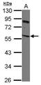 Signal Regulatory Protein Gamma antibody, PA5-21657, Invitrogen Antibodies, Western Blot image 