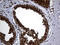 Proteasome Subunit Alpha 7 antibody, M05091-1, Boster Biological Technology, Immunohistochemistry paraffin image 