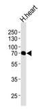 Caseinolytic Mitochondrial Matrix Peptidase Chaperone Subunit antibody, MBS9203878, MyBioSource, Western Blot image 