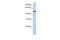 Pleckstrin Homology Like Domain Family A Member 1 antibody, GTX45378, GeneTex, Western Blot image 