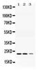 Adenylate Kinase 1 antibody, PB10033, Boster Biological Technology, Western Blot image 