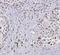 Cysteine And Glycine Rich Protein 1 antibody, FNab02029, FineTest, Immunohistochemistry paraffin image 