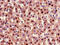 Glucagon Receptor antibody, CSB-PA009316LA01HU, Cusabio, Immunohistochemistry frozen image 
