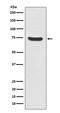 Mitogen-Activated Protein Kinase Kinase Kinase 2 antibody, M02354, Boster Biological Technology, Western Blot image 