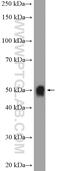 UDP Glucuronosyltransferase Family 2 Member B7 antibody, 16661-1-AP, Proteintech Group, Western Blot image 