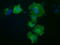 Protein Kinase D2 antibody, LS-C115679, Lifespan Biosciences, Immunofluorescence image 