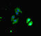 Chromodomain Helicase DNA Binding Protein 4 antibody, LS-C677526, Lifespan Biosciences, Immunofluorescence image 