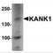 KN motif and ankyrin repeat domain-containing protein 1 antibody, MBS153365, MyBioSource, Western Blot image 