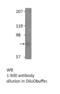 Glucagon Like Peptide 2 Receptor antibody, MBS540226, MyBioSource, Western Blot image 