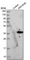 Protein Phosphatase 1 Regulatory Subunit 3B antibody, HPA028731, Atlas Antibodies, Western Blot image 