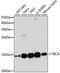 Tubulin Folding Cofactor A antibody, A13050, ABclonal Technology, Western Blot image 