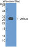 Cellular Communication Network Factor 2 antibody, LS-C314334, Lifespan Biosciences, Western Blot image 