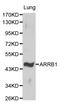 Arrestin Beta 1 antibody, LS-C192323, Lifespan Biosciences, Western Blot image 