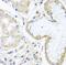 Inositol Polyphosphate-5-Phosphatase K antibody, FNab04331, FineTest, Immunohistochemistry frozen image 