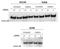 ATM Serine/Threonine Kinase antibody, NB100-678, Novus Biologicals, Western Blot image 