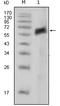 AXL Receptor Tyrosine Kinase antibody, STJ97857, St John