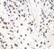 SRY-Box 5 antibody, FNab08127, FineTest, Immunohistochemistry paraffin image 