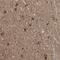 Dihydropyrimidinase Like 3 antibody, NBP1-85447, Novus Biologicals, Immunohistochemistry frozen image 