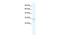 Transient Receptor Potential Cation Channel Subfamily M Member 3 antibody, GTX47454, GeneTex, Western Blot image 