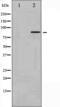 Nuclear Receptor Subfamily 3 Group C Member 1 antibody, abx011845, Abbexa, Western Blot image 
