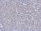 Cell Division Cycle 34 antibody, GTX70125, GeneTex, Immunohistochemistry paraffin image 