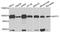 Glucosamine--fructose-6-phosphate aminotransferase [isomerizing] 1 antibody, A3882, ABclonal Technology, Western Blot image 