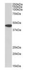 Alpha-Methylacyl-CoA Racemase antibody, orb195339, Biorbyt, Western Blot image 