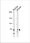 Toll Like Receptor Adaptor Molecule 1 antibody, TA325013, Origene, Western Blot image 