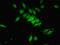 Proteasome Inhibitor Subunit 1 antibody, LS-C676330, Lifespan Biosciences, Immunofluorescence image 
