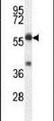 TBCC Domain Containing 1 antibody, PA5-24074, Invitrogen Antibodies, Western Blot image 