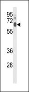 Lysophosphatidylcholine acyltransferase 1 antibody, LS-C163405, Lifespan Biosciences, Western Blot image 