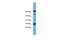 Transmembrane Protein 107 antibody, PA5-43492, Invitrogen Antibodies, Western Blot image 