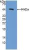 Procalcitonin antibody, LS-C372575, Lifespan Biosciences, Western Blot image 