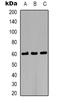 AKT Serine/Threonine Kinase 2 antibody, LS-C413604, Lifespan Biosciences, Western Blot image 