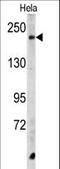 Carboxypeptidase D antibody, LS-C166986, Lifespan Biosciences, Western Blot image 