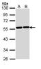Tubulin Alpha 8 antibody, GTX110432, GeneTex, Western Blot image 