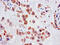 Solute Carrier Family 18 Member A1 antibody, CSB-PA021426LA01HU, Cusabio, Immunohistochemistry paraffin image 