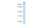 Poly(ADP-Ribose) Polymerase Family Member 9 antibody, GTX47754, GeneTex, Western Blot image 